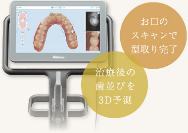 お口のスキャンで型取り完了、治療後の歯並びを3D予測