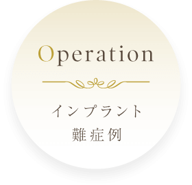 Operation：インプラント難症例